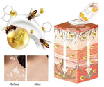 Bee Venom Vitigo Correcting Cream - (Pack of 2)