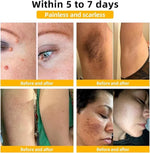 Dermasia Skin Lightening Blemish Cream 50g